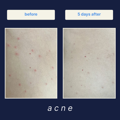 Skeen Hypochlorous Acid Facial Spray