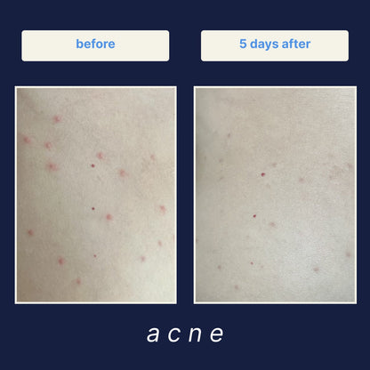 Skeen Facial Spray before and after