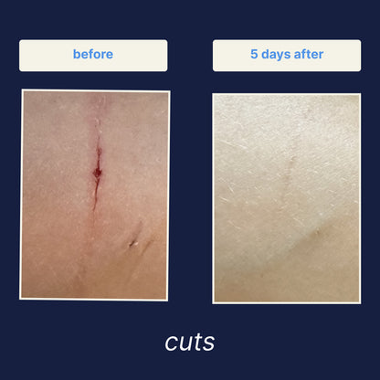 Wound Cleanser 3-Pack