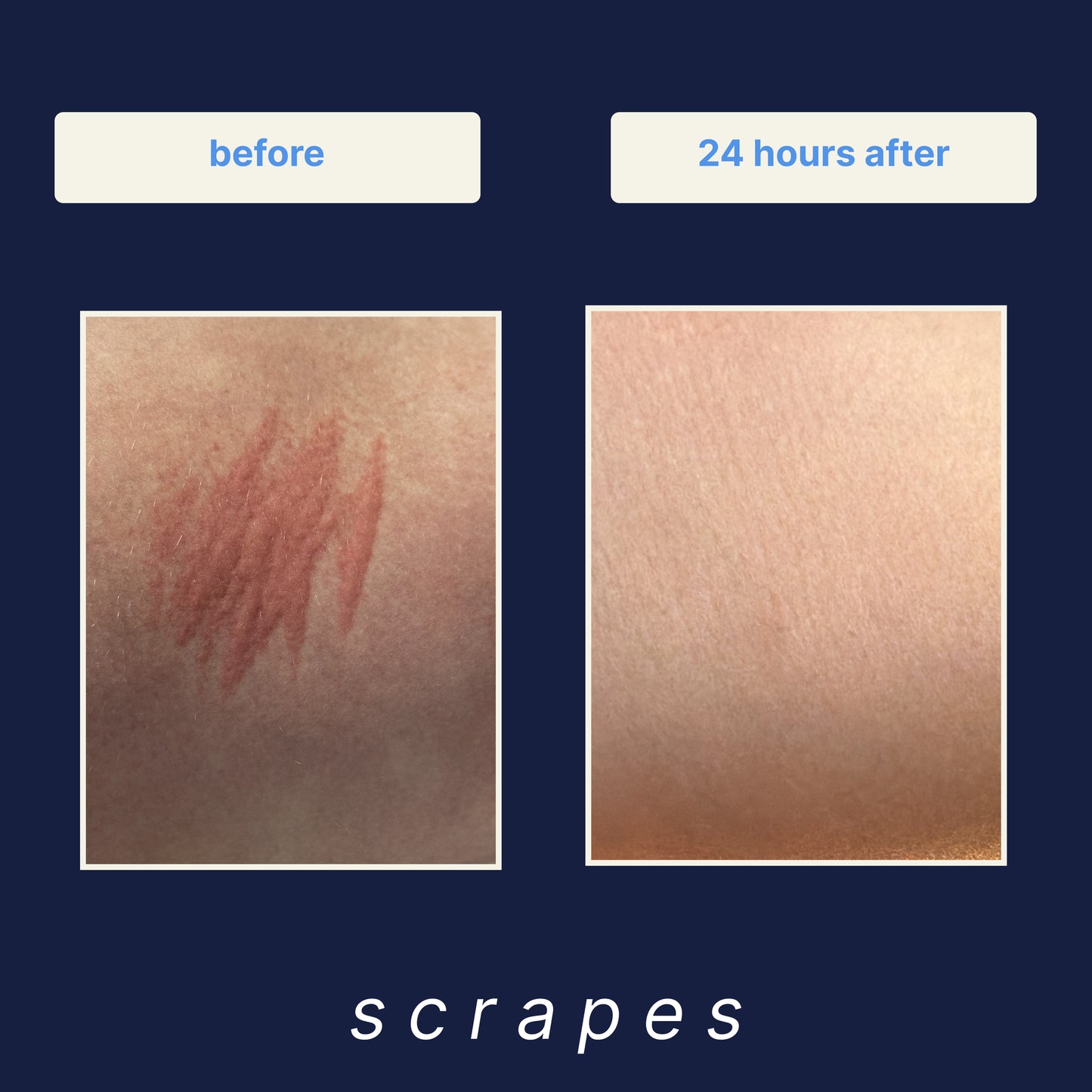 Wound Cleanser 3-Pack