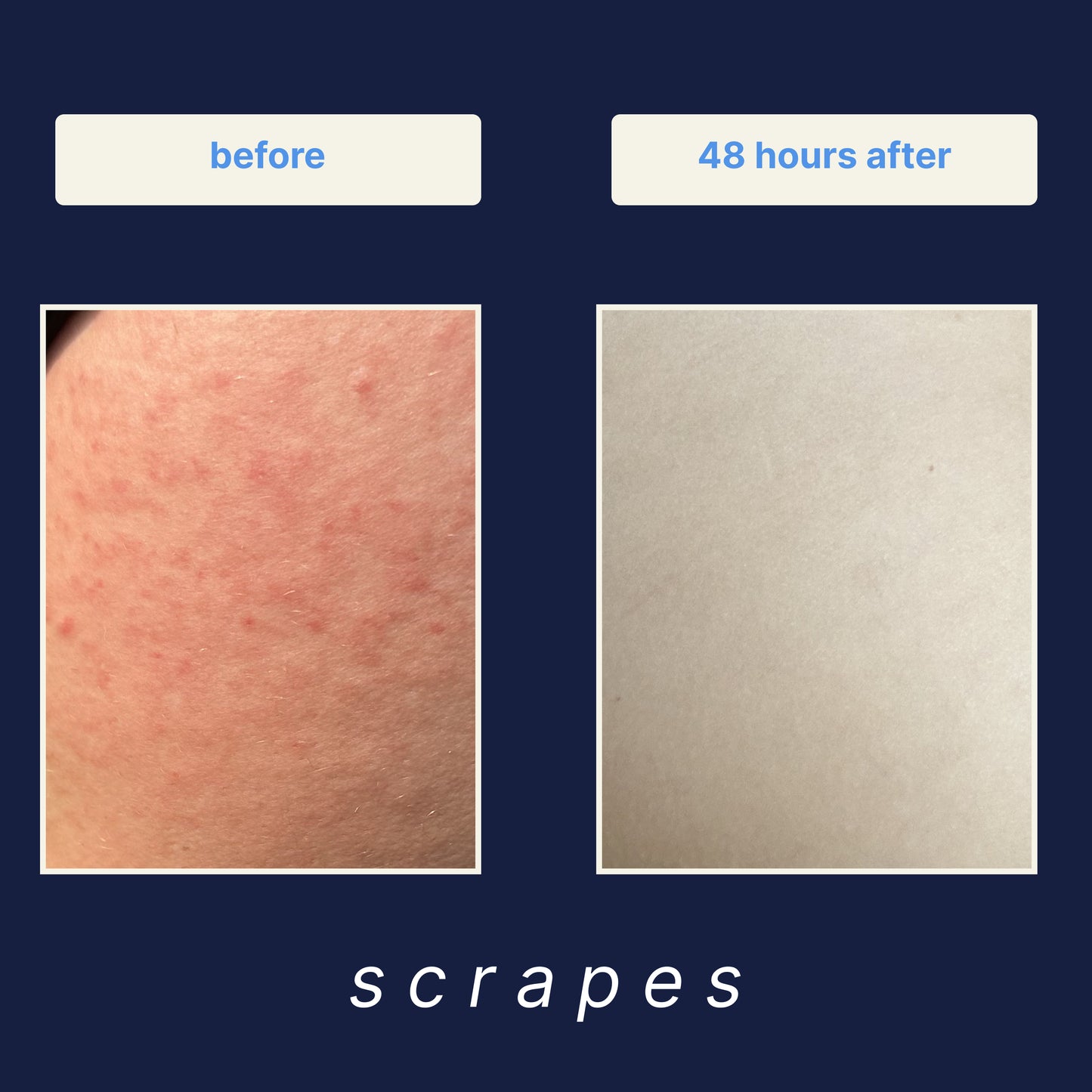 Wound Cleanser 3-Pack