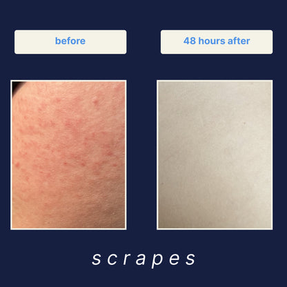 Wound Cleanser 3-Pack