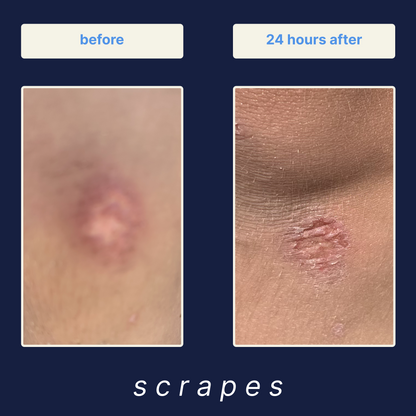 Wound Cleanser 3-Pack